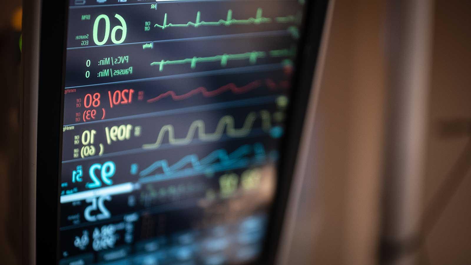 hospital monitor displaying cardiac information